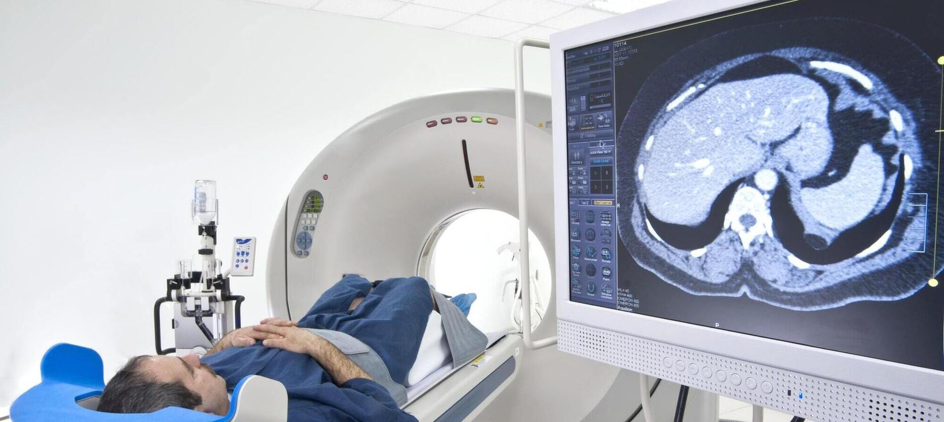 London Radiology | CT Colonoscopy London | London Radiology | London ...