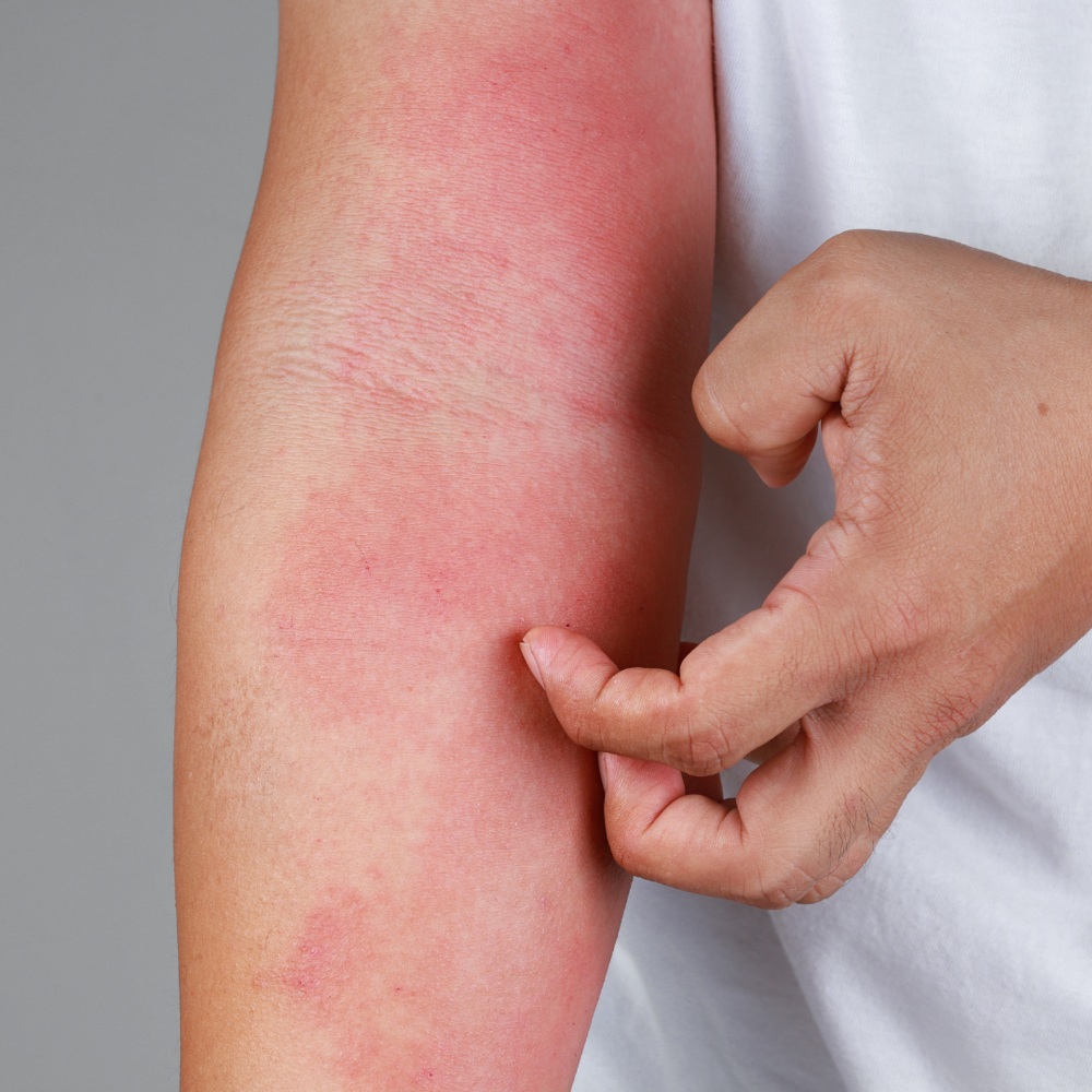 Can an unhealthy gut be the root cause of your skin issues?