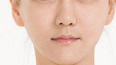Botox Birmingham, Lip fillers Birmingham, Anti-wrinkle treatment Birmingham